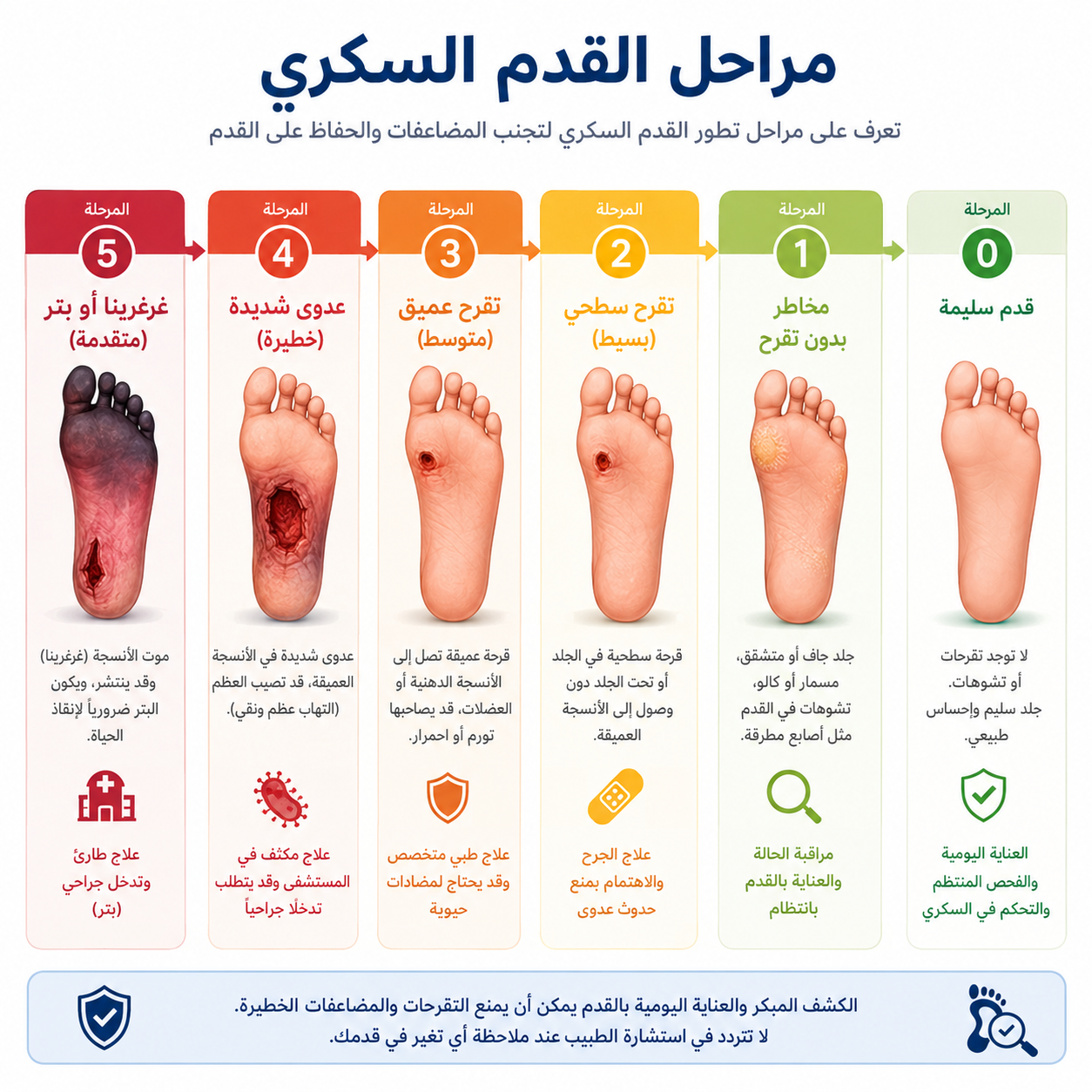 مخطط قرح القدم السكري والقدم السكري